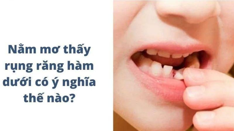 Nằm mơ thấy rụng răng hàm dưới có ý nghĩa như thế nào?
