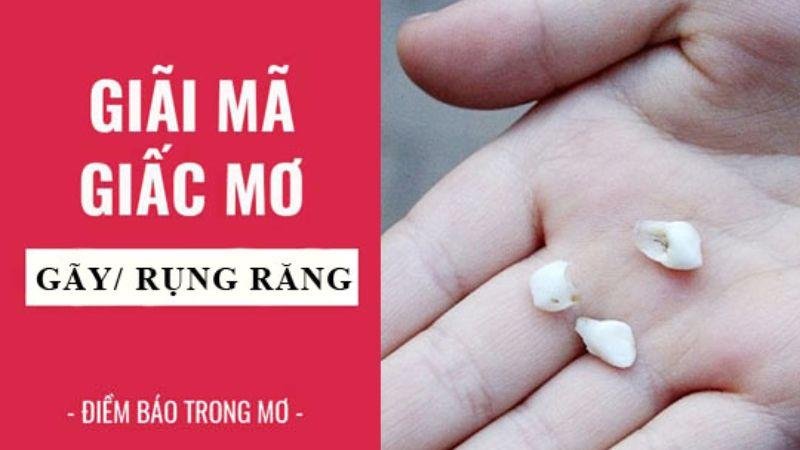 Liên Kết Giữa Việc Nằm Mơ Thấy Rụng Răng Hàm Dưới Và Xổ Số