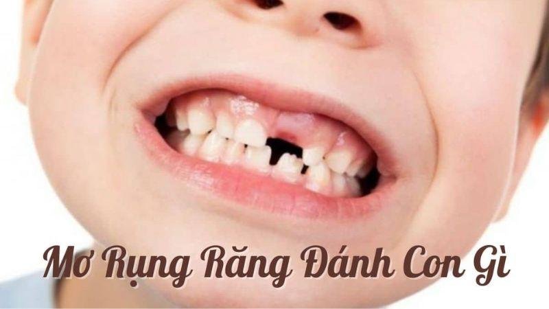 Khi mơ thấy rụng răng người chơi số đã tìm ra con số may mắn cho mình