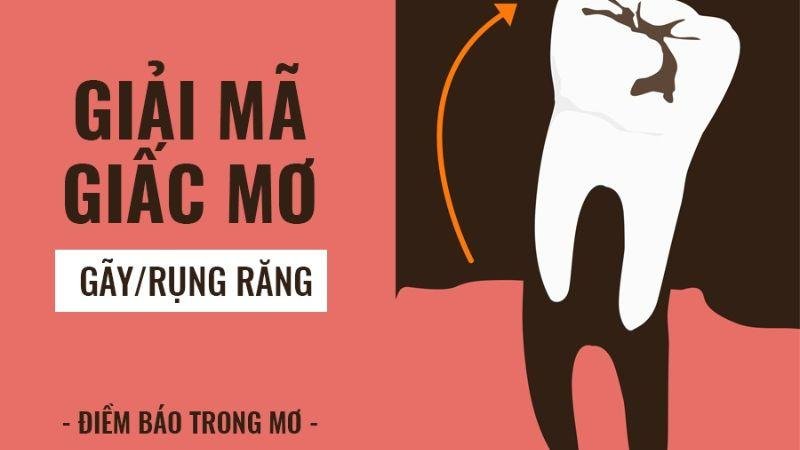 Giải mã giấc mơ khi nằm mơ thấy gẫy răng trong lô đề