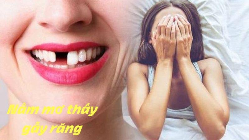 Những quan tâm và niềm tin vào các con số trong giấc mơ bị gẫy răng